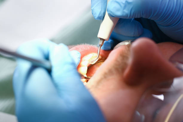 Best Orthodontic Emergency Dentist in Marianna, FL