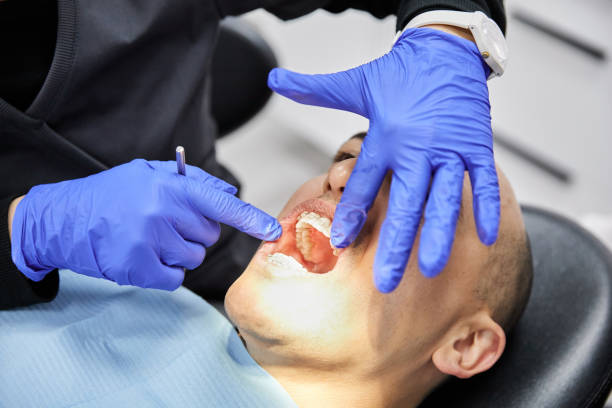 Best Emergency Dentist for Lost Fillings or Crowns in Marianna, FL